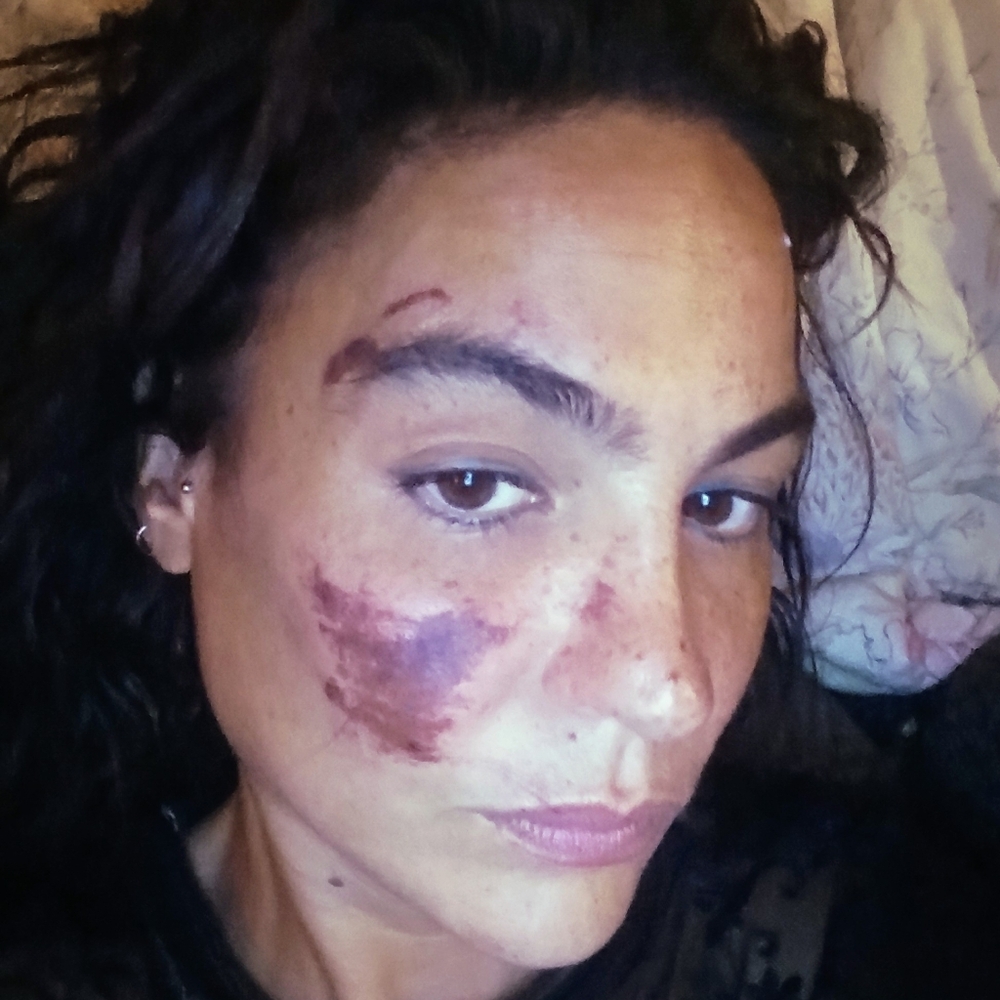 https://gofund.me/c98591b9 - Picture 7 of 7